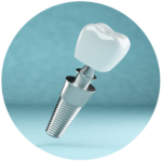 Implante dental de alta calidad, parte de los servicios de prótesis dental en Serviprodent, Valdemorillo