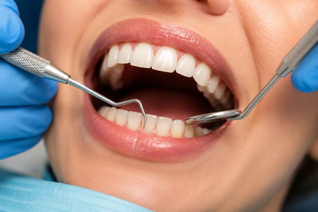 ¿Qué es un curetaje dentall?
